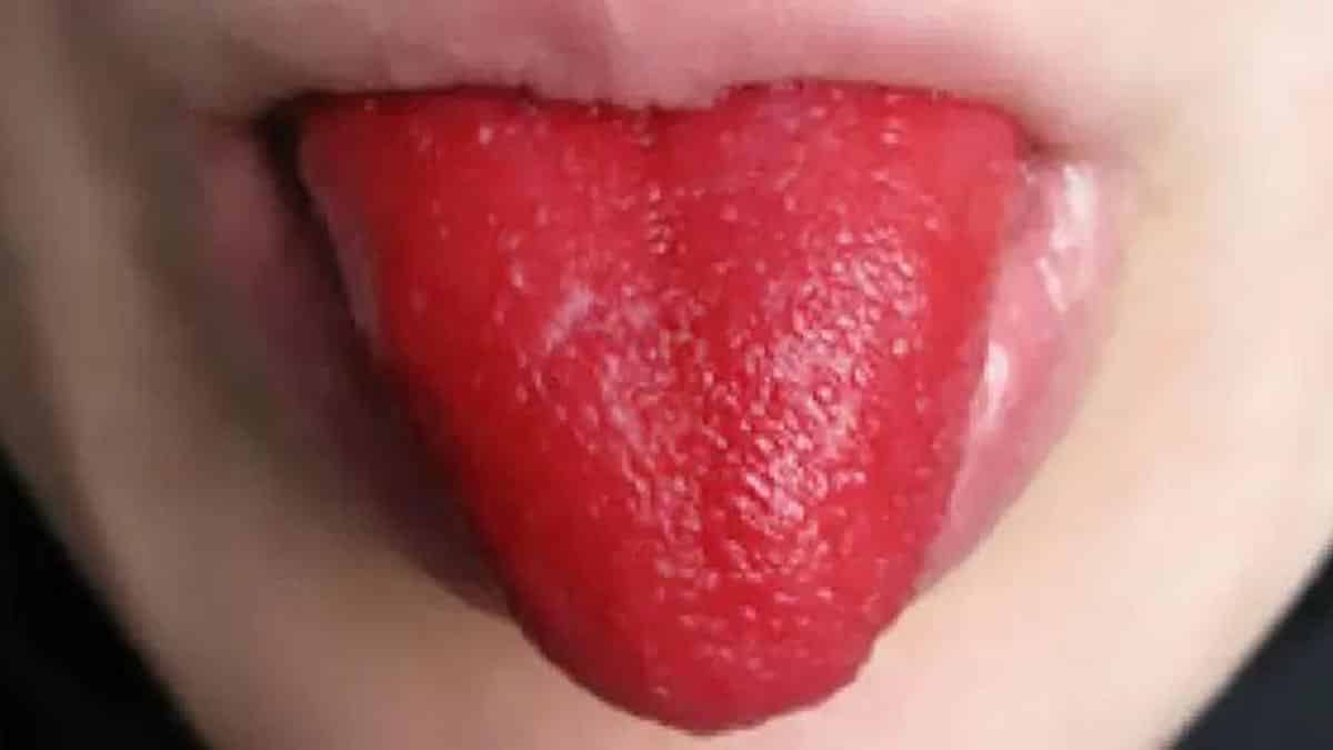 langue rose fraise